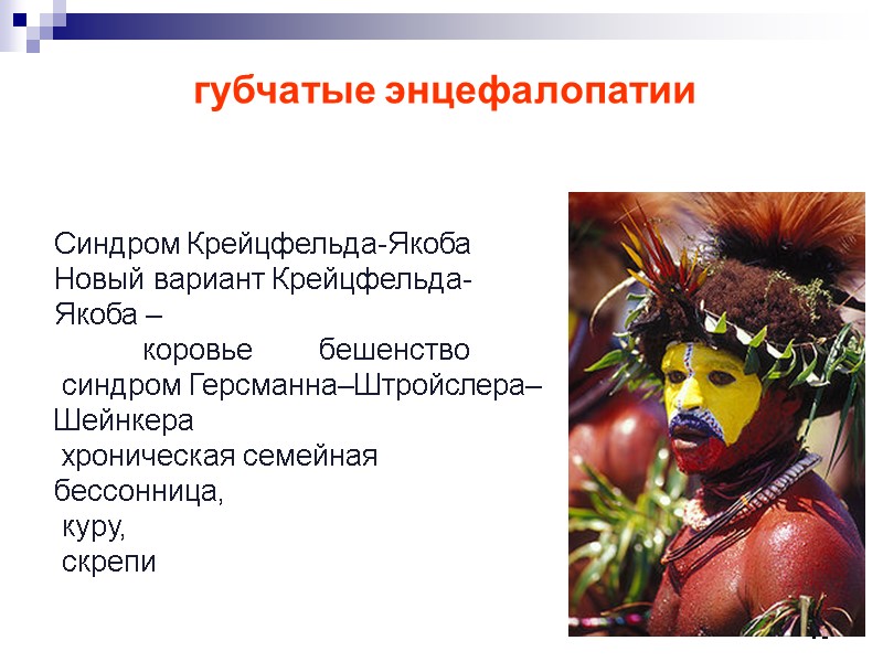 70 губчатые энцефалопатии Синдром Крейцфельда-Якоба  Новый вариант Крейцфельда-Якоба –   коровье 